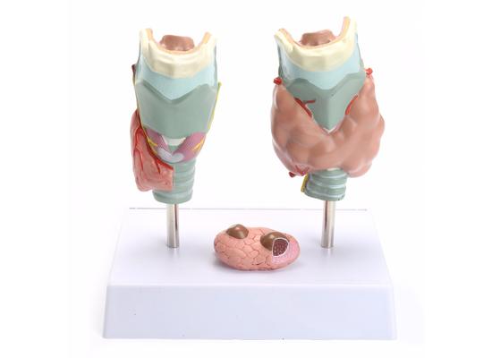 Модель заболеваний щитовидной железы, 4 части