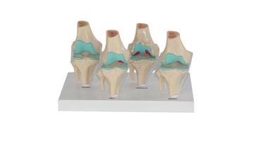 Комплексная модель коленного сустава в натуральную величину